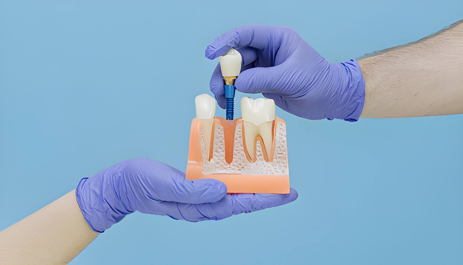 Experienced Implant Dentist in Lanark